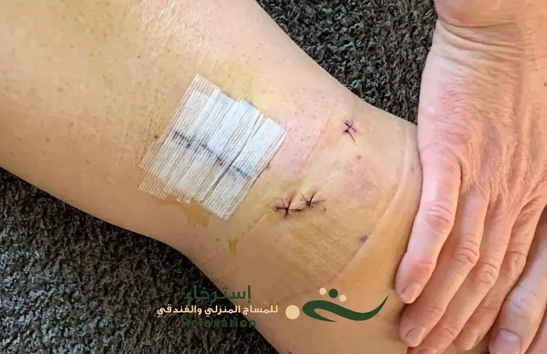المساج والتدليك الاستشفائي في الرياض