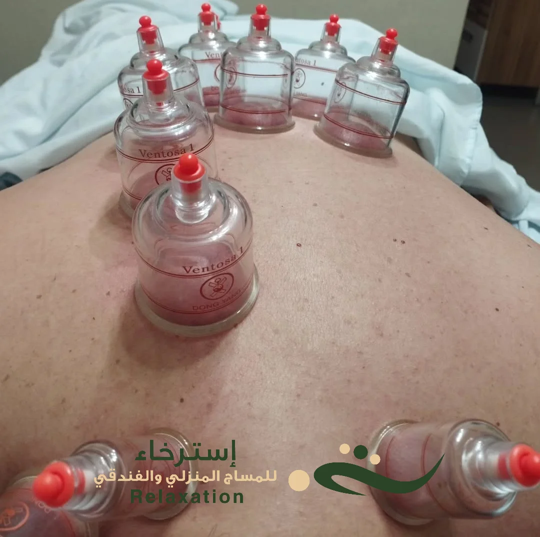 طريقة مساج كاسات هواء الظهر في الرياض