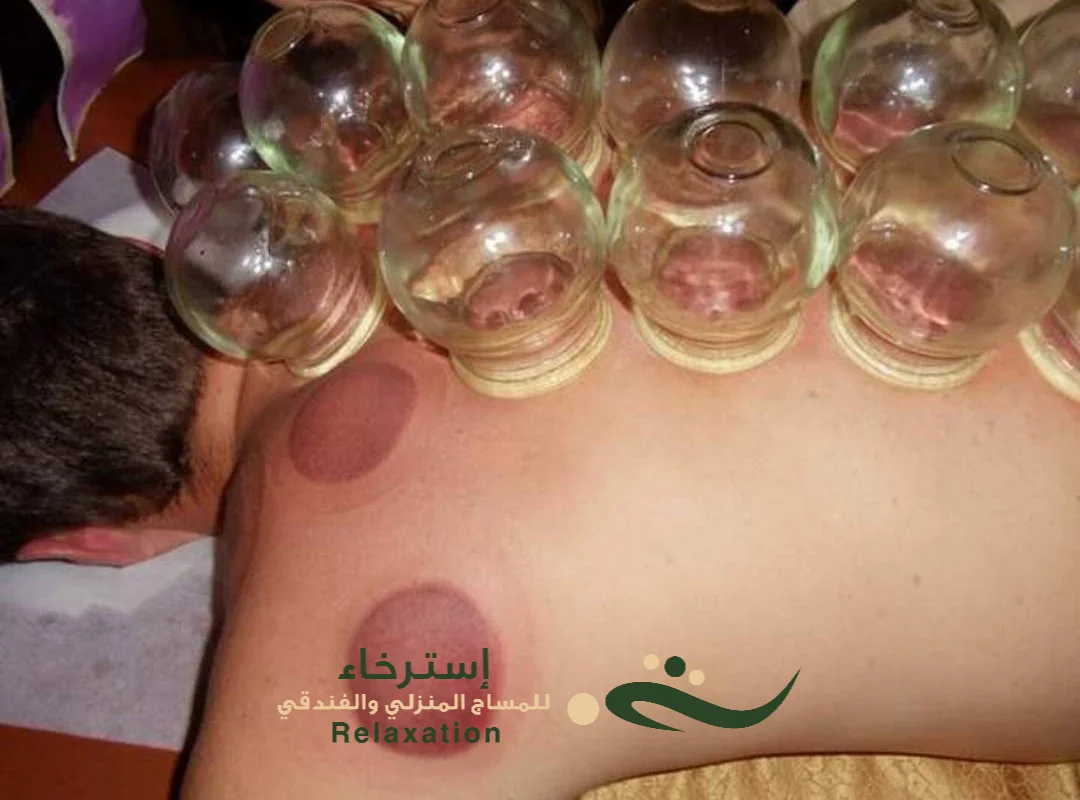 فوائد مساج الكاسات في الرياض