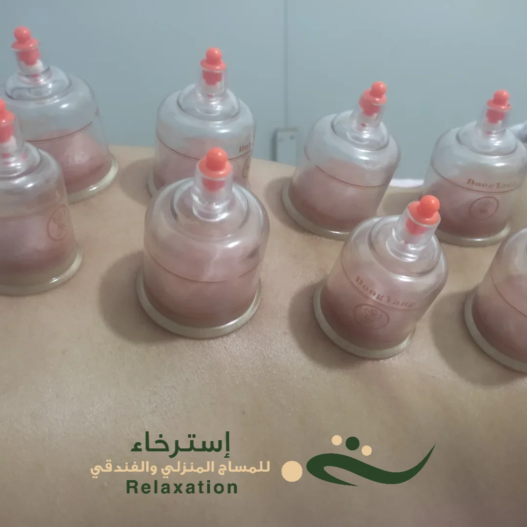 فوائد مساج كاسات الهواء بحي اليرموك بالرياض