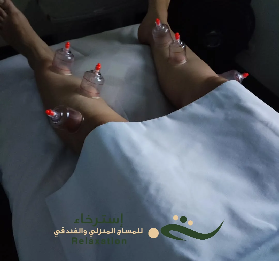 كاسات الحجامه الجافه بالرياض