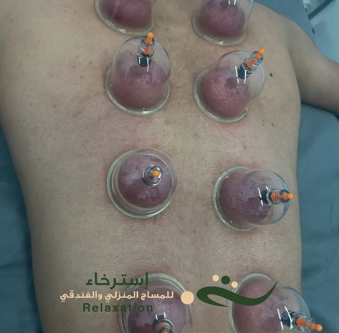 كاسات مساج جنوب الرياض