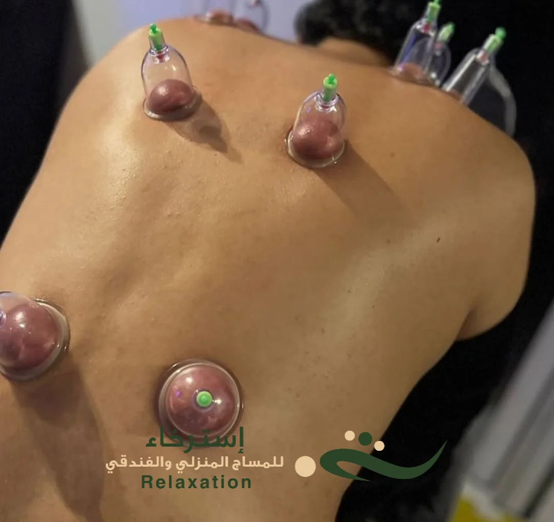 كيفيه عمل مساج كاسات الهواء في الرياض بالدار البيضاء