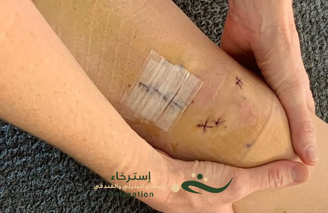 ما هو المساج الاستشفائي بالرياض