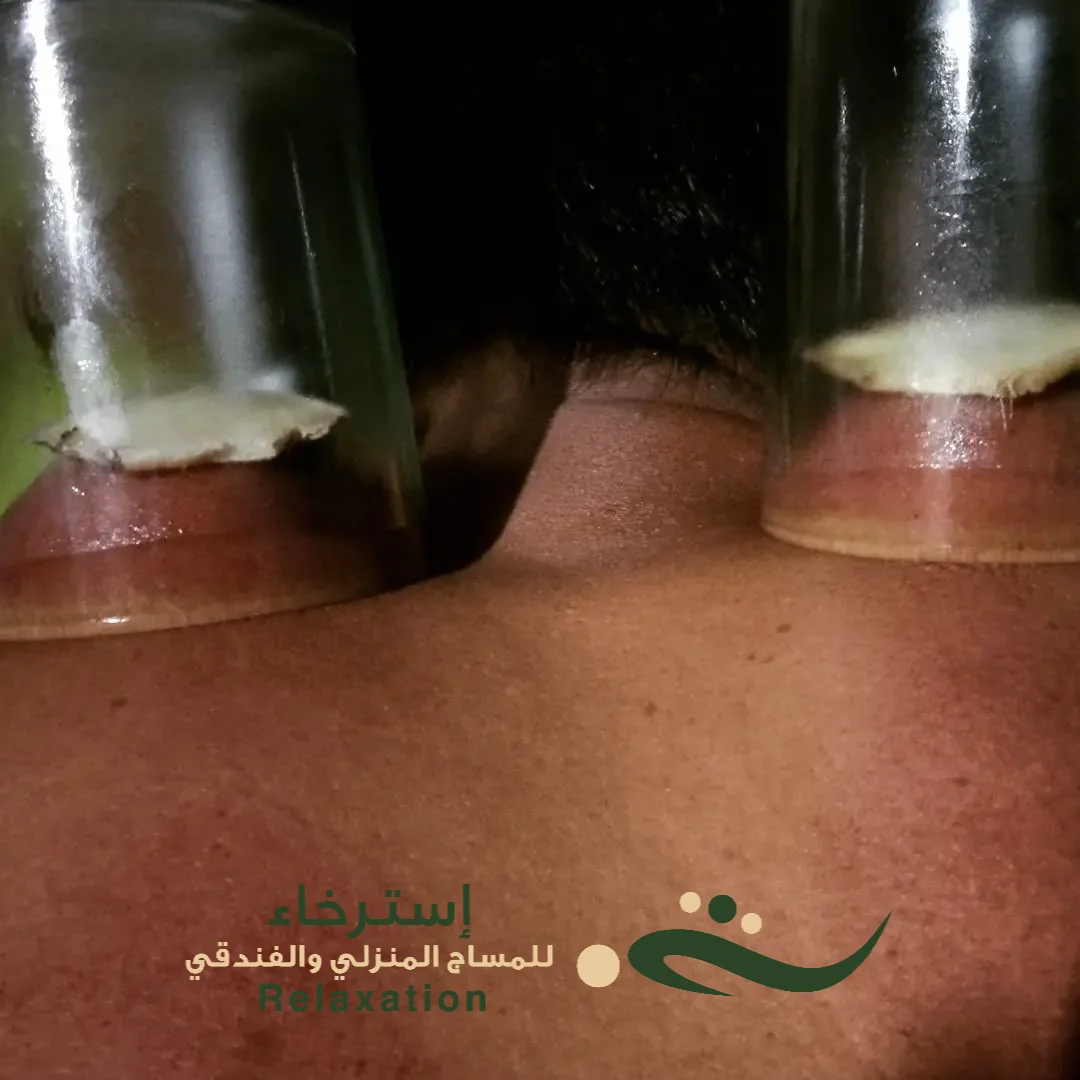 مساج الكاسات بالرياض حي حطين